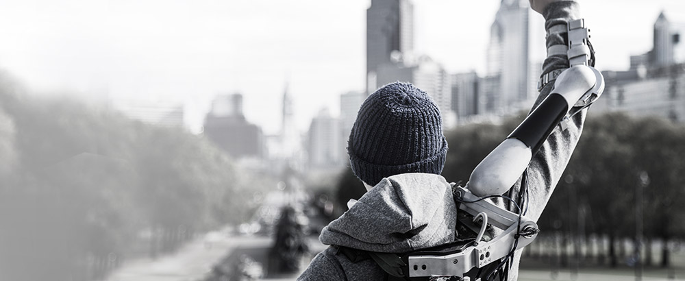 James Dyson Award - Titan Arm